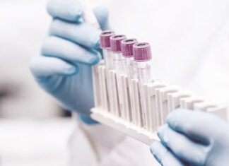 Háziorvos által kérhető laborvizsgálatok